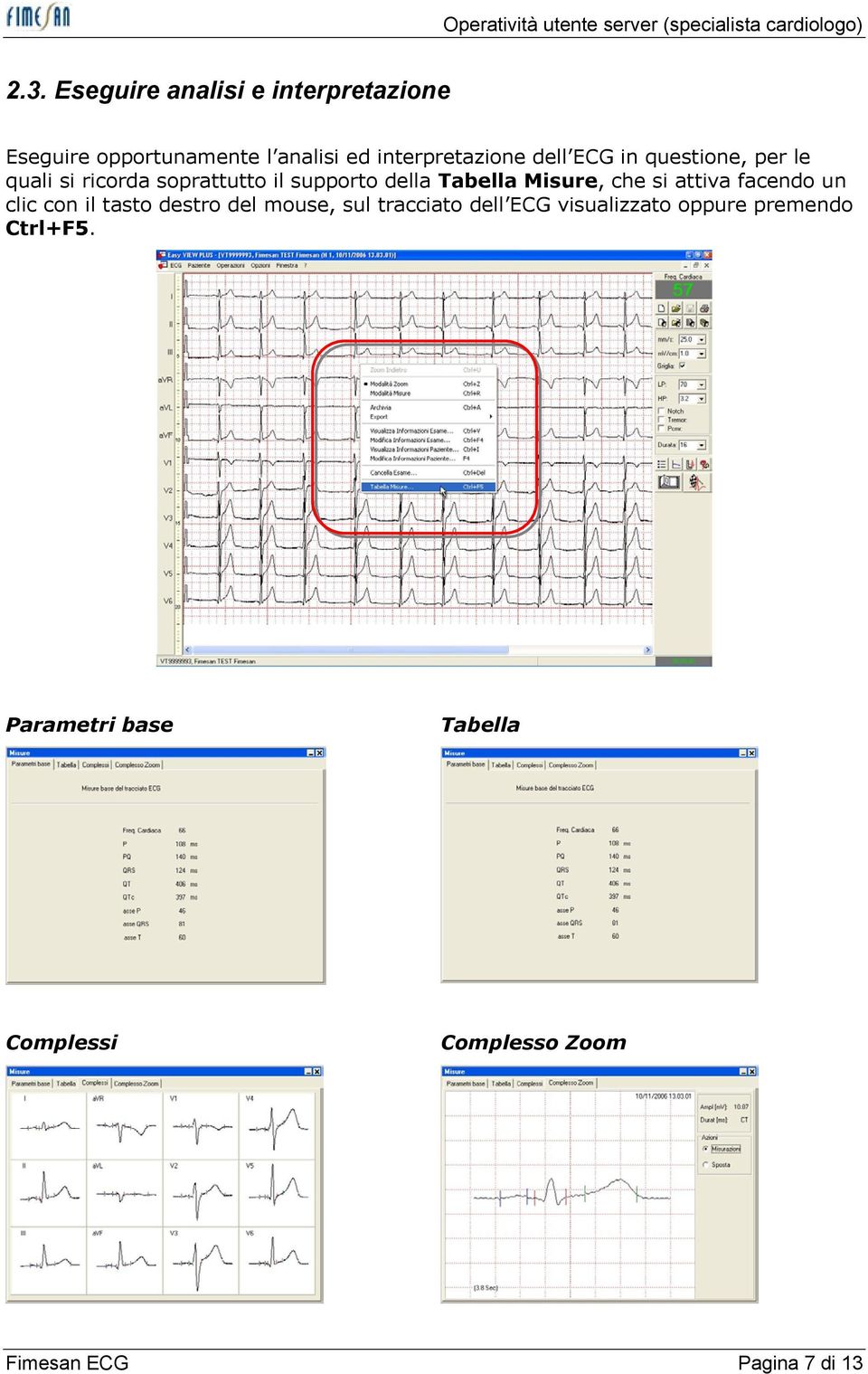 che si attiva facendo un clic con il tasto destro del mouse, sul tracciato dell ECG