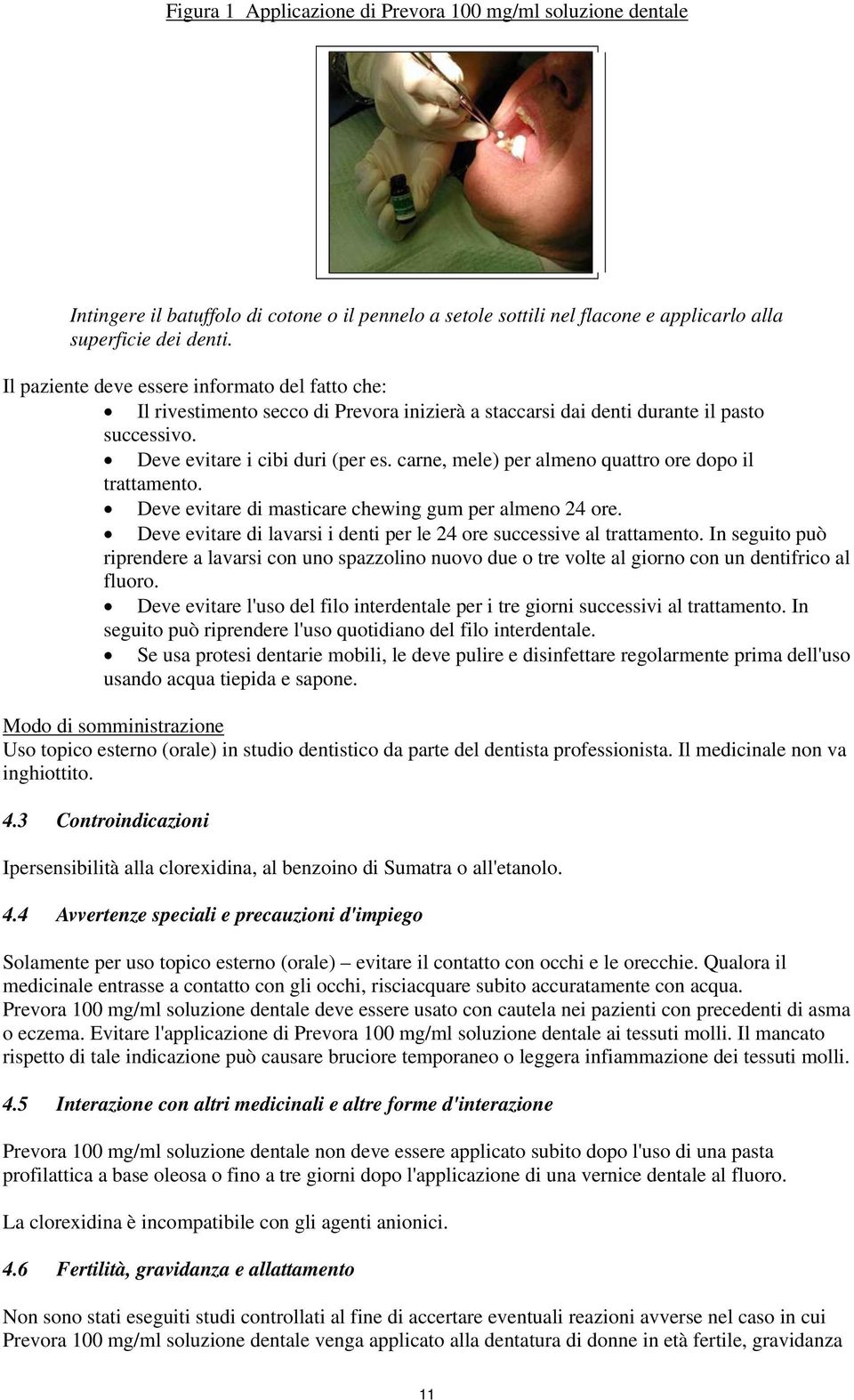 carne, mele) per almeno quattro ore dopo il trattamento. Deve evitare di masticare chewing gum per almeno 24 ore. Deve evitare di lavarsi i denti per le 24 ore successive al trattamento.