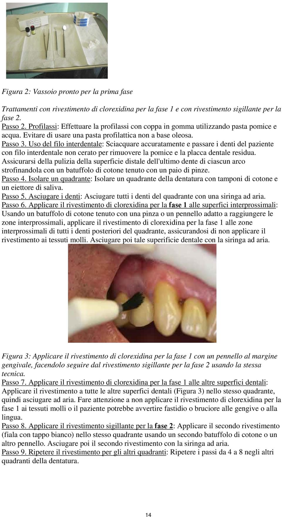 Uso del filo interdentale: Sciacquare accuratamente e passare i denti del paziente con filo interdentale non cerato per rimuovere la pomice e la placca dentale residua.