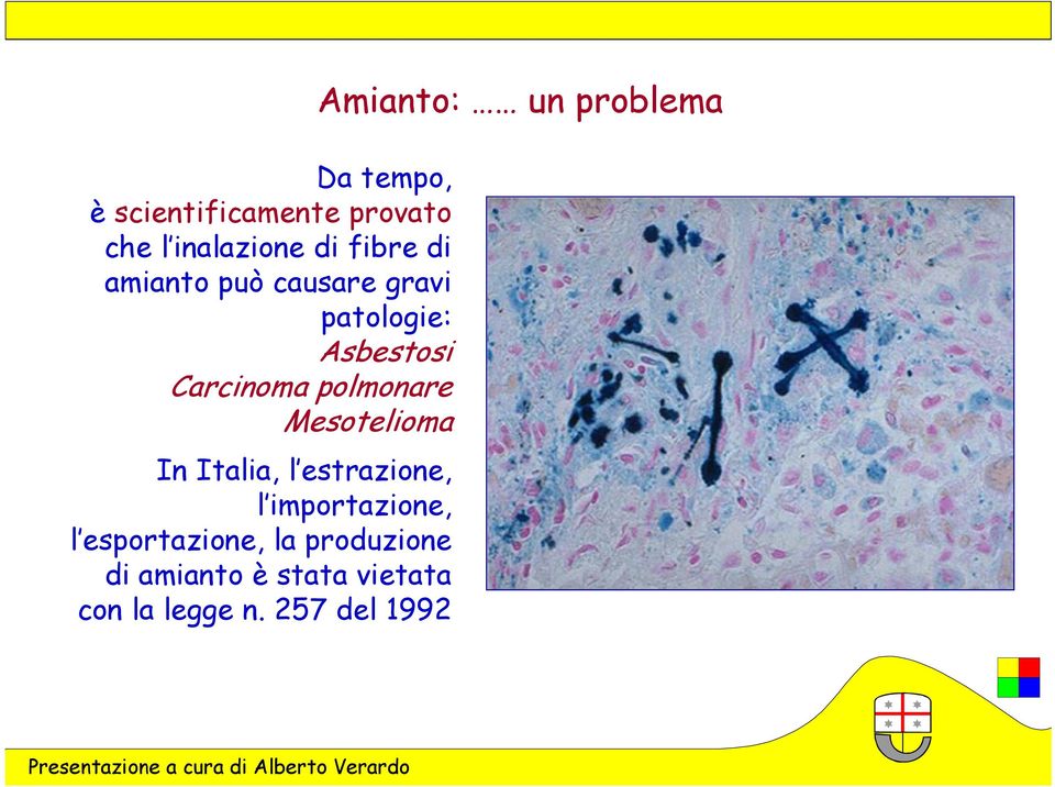 Mesotelioma In Italia, l estrazione, l importazione, l esportazione, la