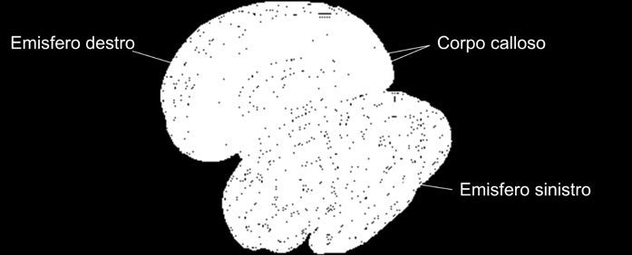 Il cervello è diviso a metà in due emisferi: emisfero destro e emisfero sinistro. Queste due parti sono messe in comunicazione tra loro da una fitta rete di fibre, detta corpo calloso. Fig. 2.