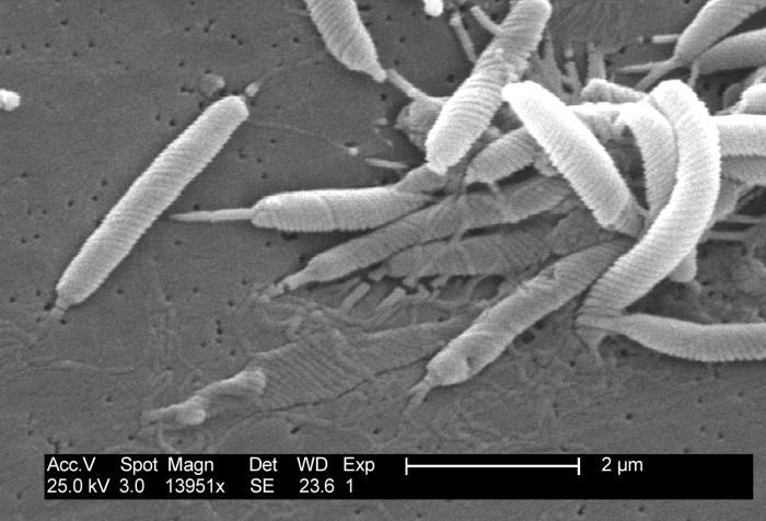 Helicobacter Pylori http://commons.wikimedia.org/wiki/file:hpylori.jpg Cosa possiamo vedere?