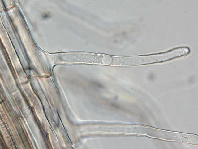 Una epidermide molto particolare: il rizoderma avvolge la parte distale del corpo primario della radice Cellule vive Parete sottile pectocellulosica molto permeabile i peli consentono una
