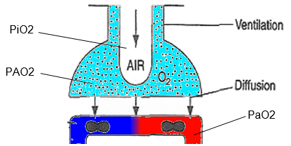 Gradiente A-aA La PAO 2 è quella che esisterebbe in un alveolo ideale, ed è calcolabile in base all equazione dell aria alveolare: PaCO2 PAO2 = PiO2 ( 1 FiO2 ( 1 R) ) R Una semplificazione clinica è: