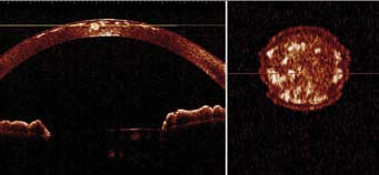 >> SS-1000 CASIA Qualità nel dettaglio << Valutazioni precise e reali - Per calcolare il suo algoritmo di correzione il CASIA valuta la curvatura di ogni singola cornea e non considera i valori di