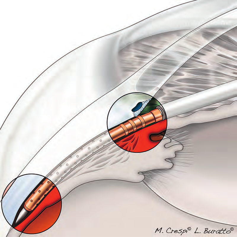 Fig.11.