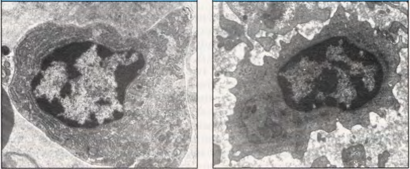 Le cellule dell immunità adattativa: i Linfociti Piccolo Linfocita ANTIGENE