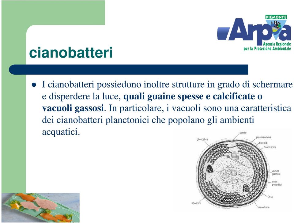 calcificate o vacuoli gassosi.