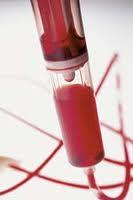 EMOCOMPONENTI La trasfusione rapida del sangue, a temperatura di conservazione o ambiente infuso velocemente in via centrale aumenta il rischio di mortalità (aritmie
