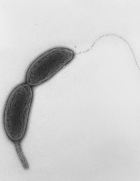 Distribuzione asimmetrica di CtrA flagellum Come viene assicurato che CtrA-P sia assente nella