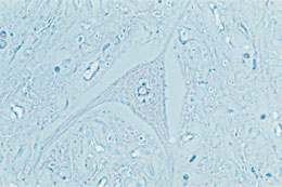 Interferenza: microscopio a contrasto di fase Questo metodo descritto nel 1934 dal fisico olandese Fritz Zernike gli ha procurato non