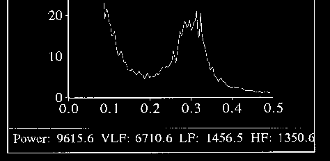 SPECTRAL HRV ANALYSIS BEFORE AND AFTER EXERCISE