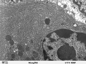 Unfolded protein response Reticoli ESEMPI DI CELLULE IN CUI IL RETICOLO ENDOPLASMATICO RUVIDO È MOLTO SVILUPPATO Micrograph of rough endoplasmic reticulum network