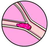 Distretti Sociosanitari LA TUA GUIDA PER LA TERAPIA ANTICOAGULANTE ORALE (TAO) Realizzato da: Personale Infermieristico Distretti Socio Sanitari Personale Medico e