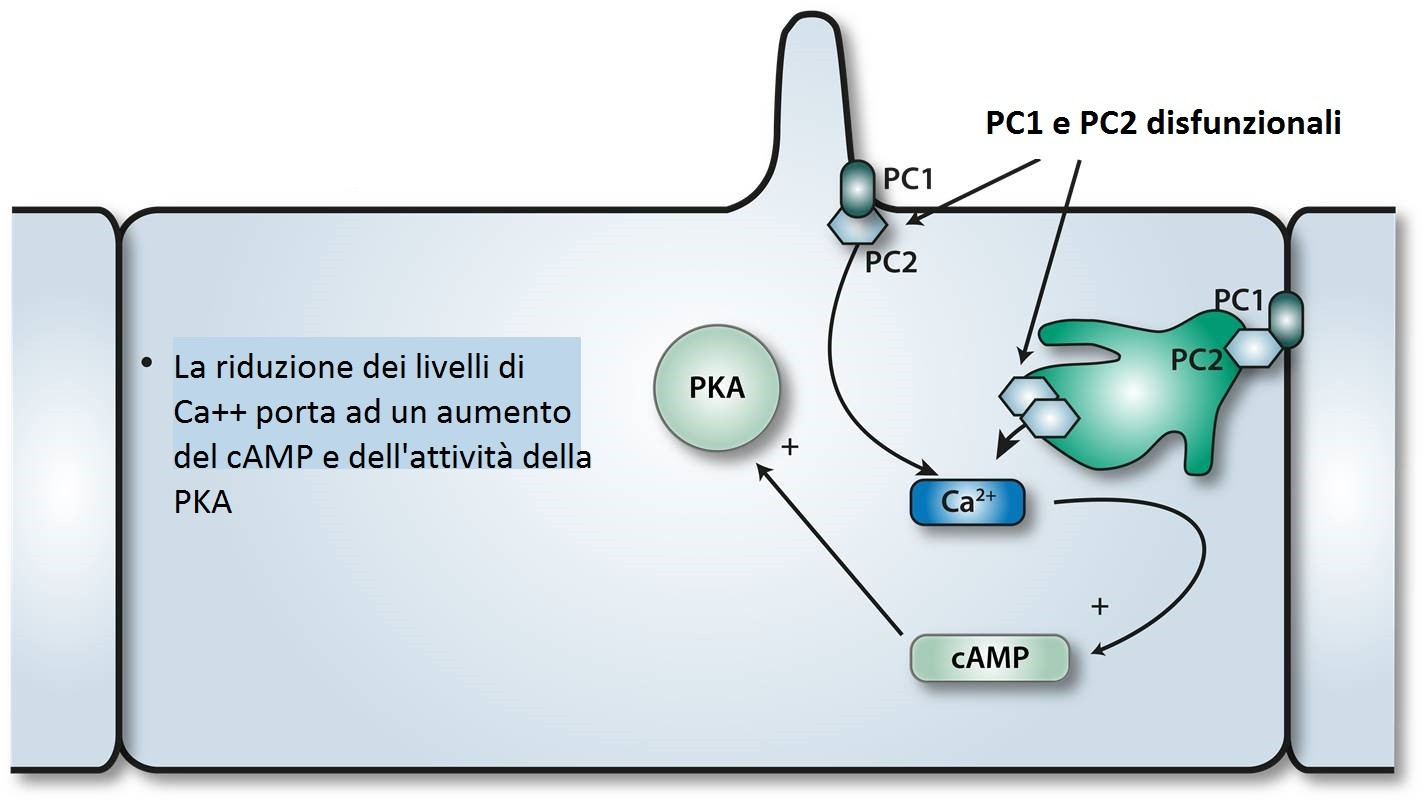 ADPKD: PATOGENESI Il malfunzionamento di PC1 o PC2, proteine codificate da PKD1 e PKD2, porta ad una riduzione dei livelli intracellulari di Ca++ + + + + Aumento proliferazione cellulare Aumento