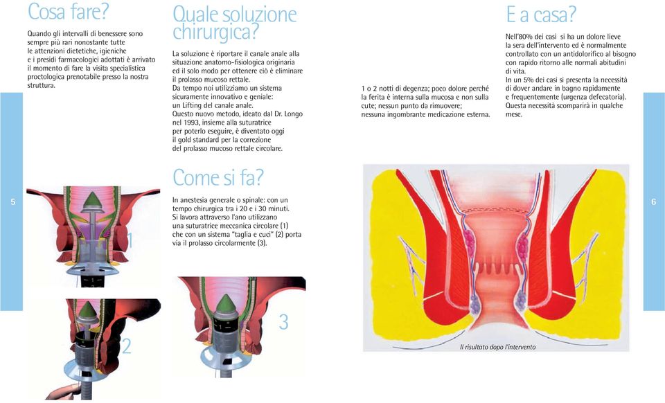 proctologica prenotabile presso la nostra struttura. Quale soluzione chirurgica?