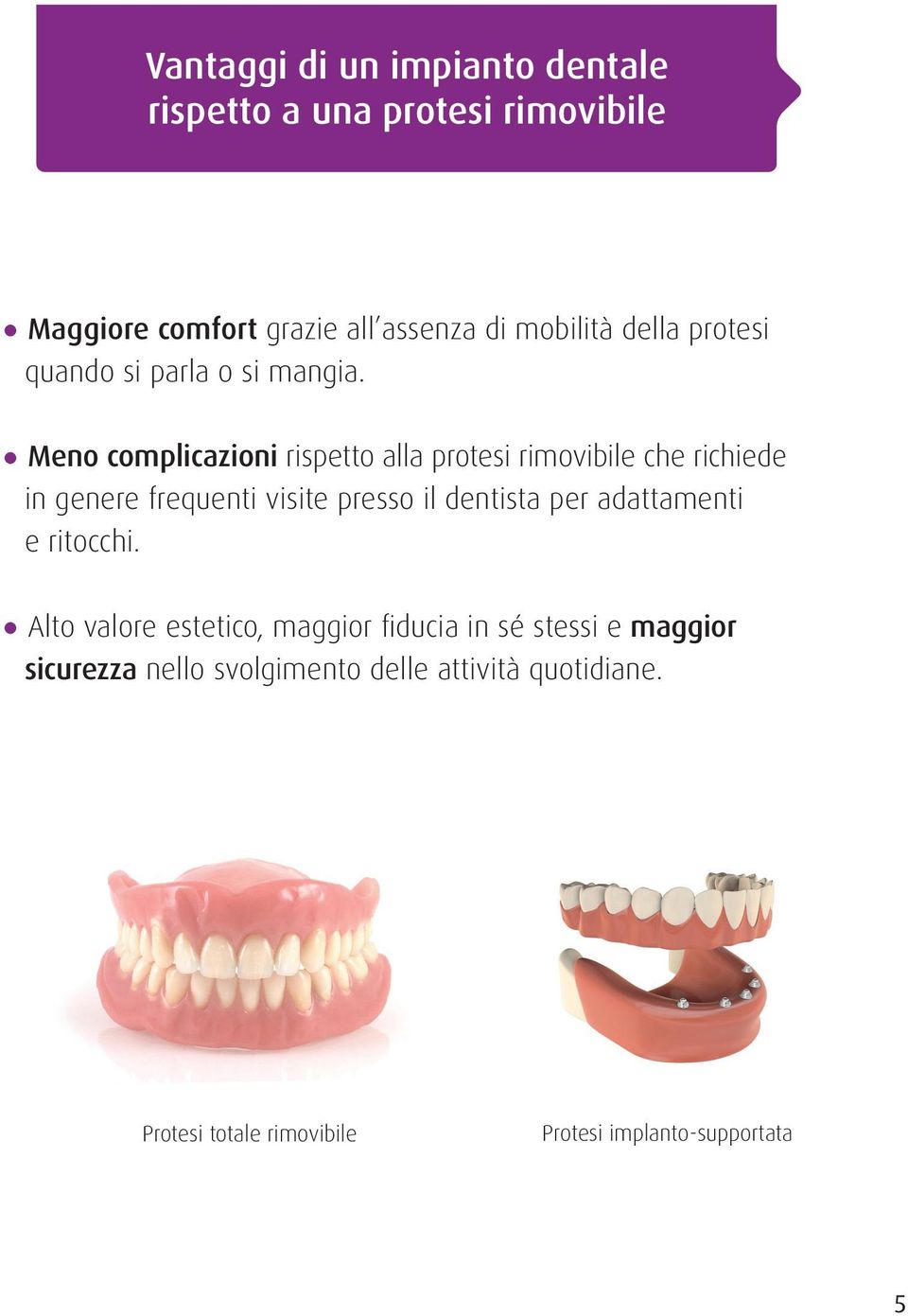 Meno complicazioni rispetto alla protesi rimovibile che richiede in genere frequenti visite presso il dentista per