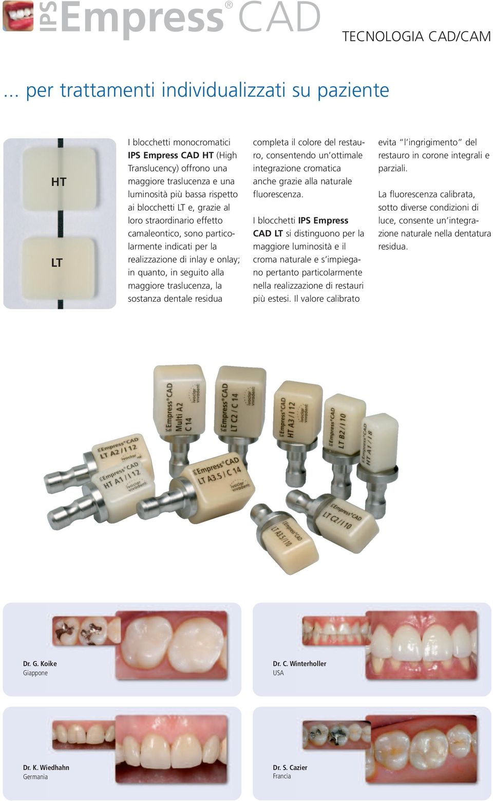 LT e, grazie al loro straordinario effetto camaleontico, sono particolarmente indicati per la realizzazione di inlay e onlay; in quanto, in seguito alla maggiore traslucenza, la sostanza dentale