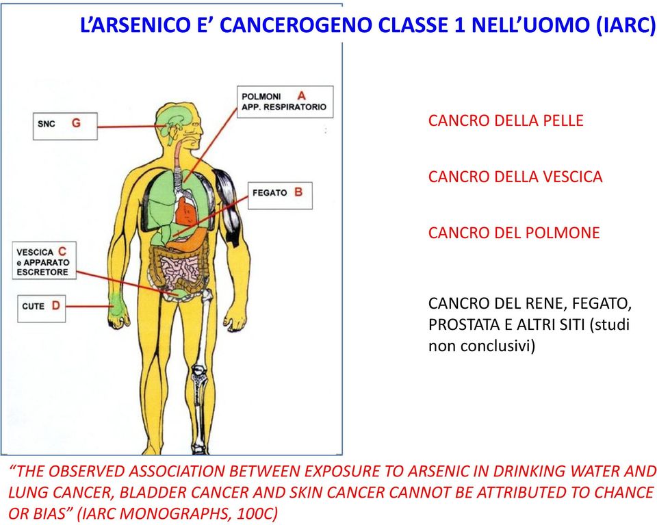 THE OBSERVED ASSOCIATION BETWEEN EXPOSURE TO ARSENIC IN DRINKING WATER AND LUNG CANCER,