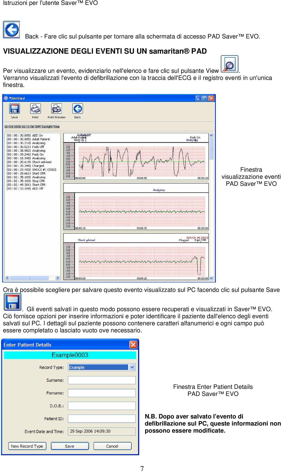 Verranno visualizzati l'evento di defibrillazione con la traccia dell'ecg e il registro eventi in un'unica finestra.