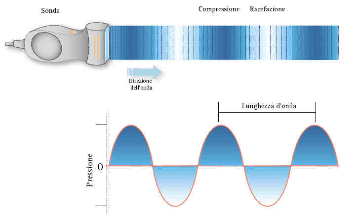 Fisica Ultrasuoni Gli ultrasuoni come tutte le onde sonore possono essere descritte come dei fenomeni di compressione e rarefazione della