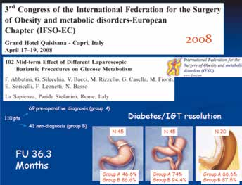 Corso di alta formazione SID Dixon JAMA 2008 Mingrone NEJM 2012 Schauer NEJM 2012 Numero pazienti 60 60 150 Intervento chirurgico Bendaggio gastrico laparoscopico Diversione biliopancreatica(bpd)/ By