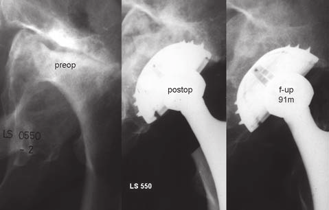 L. Spotorno, et al. Fig. 4.