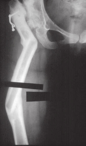 M.A. Catagni Fig. 9 chiamata a Delta.