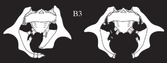 G.F. Zinghi Con la TAC si può studiare la pelvi secondo piani orizzontali prestabiliti ottenendo immagini che assomigliano a vere e proprie sezioni anatomiche.