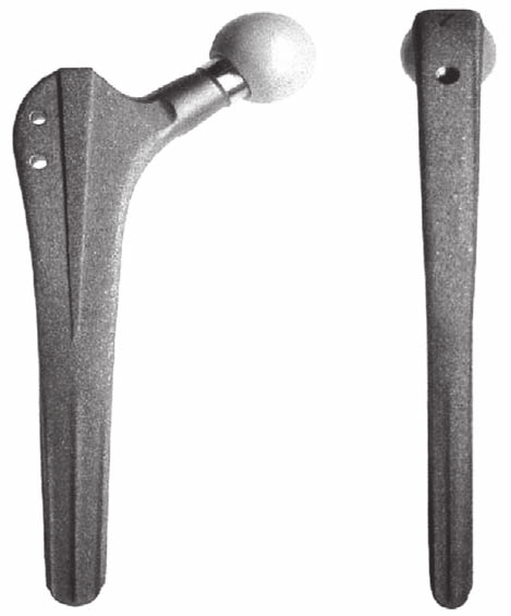 Dalla protesi su misura allo stelo retto a doppia conicità Fig. 3. Protesi totale dell anca Alloclassic (Zimmer, USA) ideata da Karl Zweymüller e utilizzata dal 1986.
