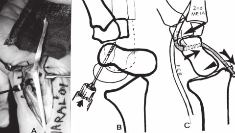 G. Brunelli Fig 2. A.