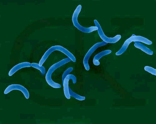 Vibrio cholerae - Gram-negative, facultatively anaerobic, curved (vibrio-shaped), rod prokaryote; causes Asiatic cholera.