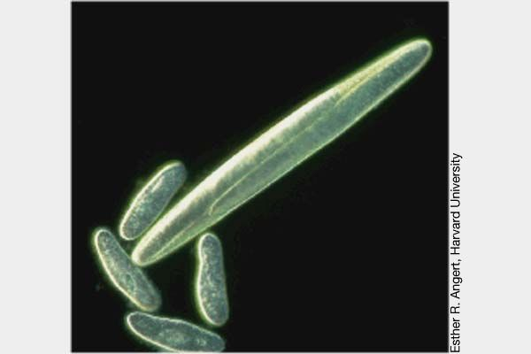 Batterio gigante Epulopiscium