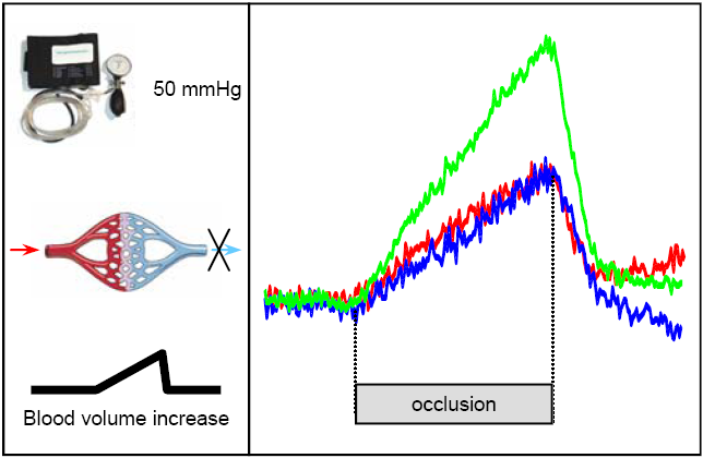 Statiche Tipi di misure Consumo di ossigeno Metodica dell occlusione venosa (HHb) Flusso Metodica dell