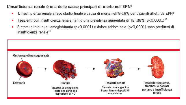 Malattia renale cronica L insufficienza renale Riferimenti: 5. Hillmen P., Elebute M, Kelly R. Et al. Am J Hematol.2010;85:553-559.