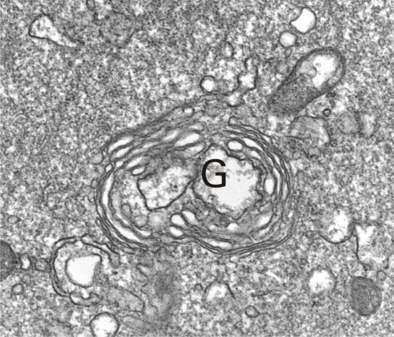Immagine al microscopio elettronico dell interno di un fibroblasto nella regione di tessuto connettivo stimolato col laser SmartXide 2 V 2 LR.