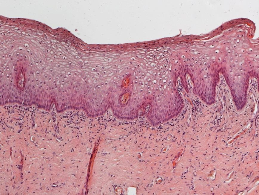 Preparazione istologica di una sezione della mucosa vaginale colorata con ematossilina e eosina (H & E). (A) : Condizioni basali.