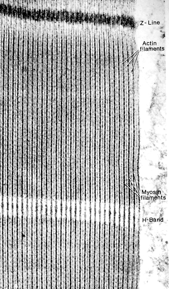 Semibanda A banda H linea M Semibanda A Linea Z Semibanda I I A H A SARCOMERO RILASSATO SARCOMERO CONTRATTO t t e T e s