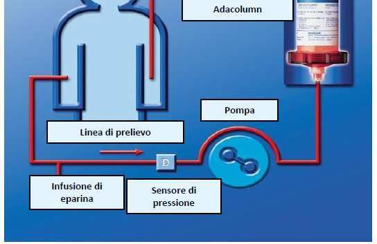 Granulocito-Monocito Aferesi (GMA) OTSUKA Struttura 35.000 sfere di acetato di cellulosa (220 gr) diluite in 130 ml soluzione salina isotonica.