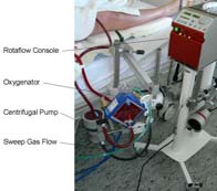 Principali situazioni patologiche nelle quali la decapneizzazione può trovare applicazione Bronchitici cronici (BPCO) Insufficienza respiratoria ipercapnica ipossemica Chirurgia toracica della