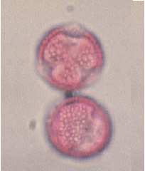 Quercia (Quercus sp.) periodo di fioritura: aprile giugno Genere rappresentato da numerose specie arboree, a foglie caduche, semplici, alterne dentate o lobate.