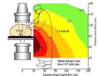 Radiazione diffusa CONFRONTO DATI: Dose cute paziente: 87
