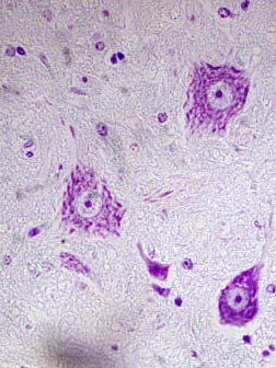 Sintetizzano molti Neurotrasmettitori Presentano strutture basofile nel citoplasma evidenziate dalla colorazione di