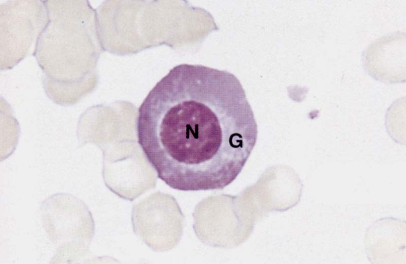 Plasma cellule Linfociti B