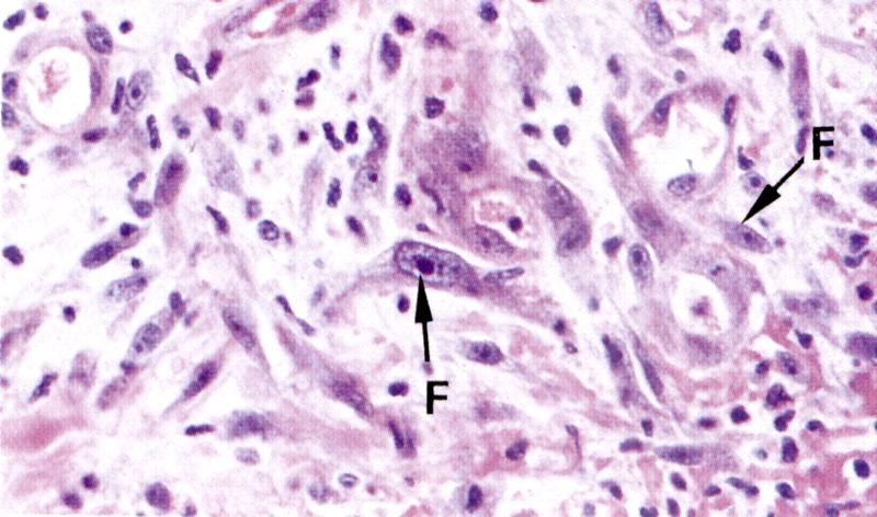 Fibroblasti Principale