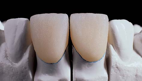 1 a Cottura Dentina Cervicale, Dentina e Smalto 1a Cottura Dentina Cervicale, Dentina e Smalto Inumidire la superficie della cappetta con il liquido Matchmaker Zr Modelling.