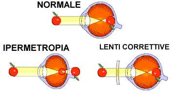 ANOMALIE