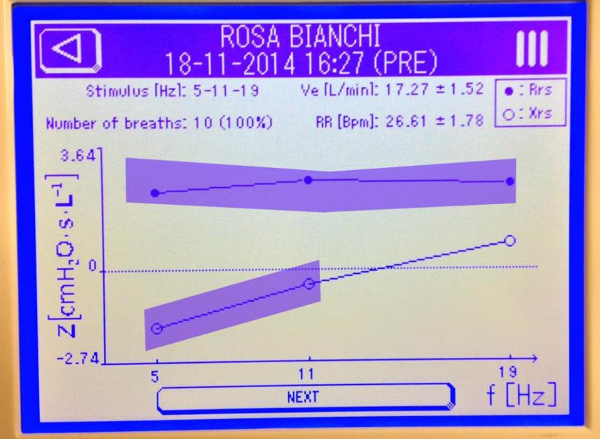 FOT Forced Oscillation Technique Resistenza Resistenza Reattanza Reattanza Ventilazione nelle vie aeree distali Sano: