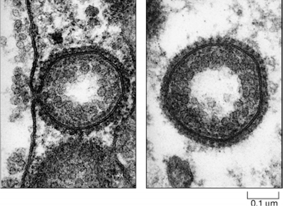 originano VESCICOLE: le vescicole pinocitiche possono