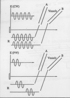 Nel CW l onda viene emessa e ricevuta in continuazione da due sonde distinte. Si riceve il segnale scatterato da tutte le particelle in moto investite dal fascio.